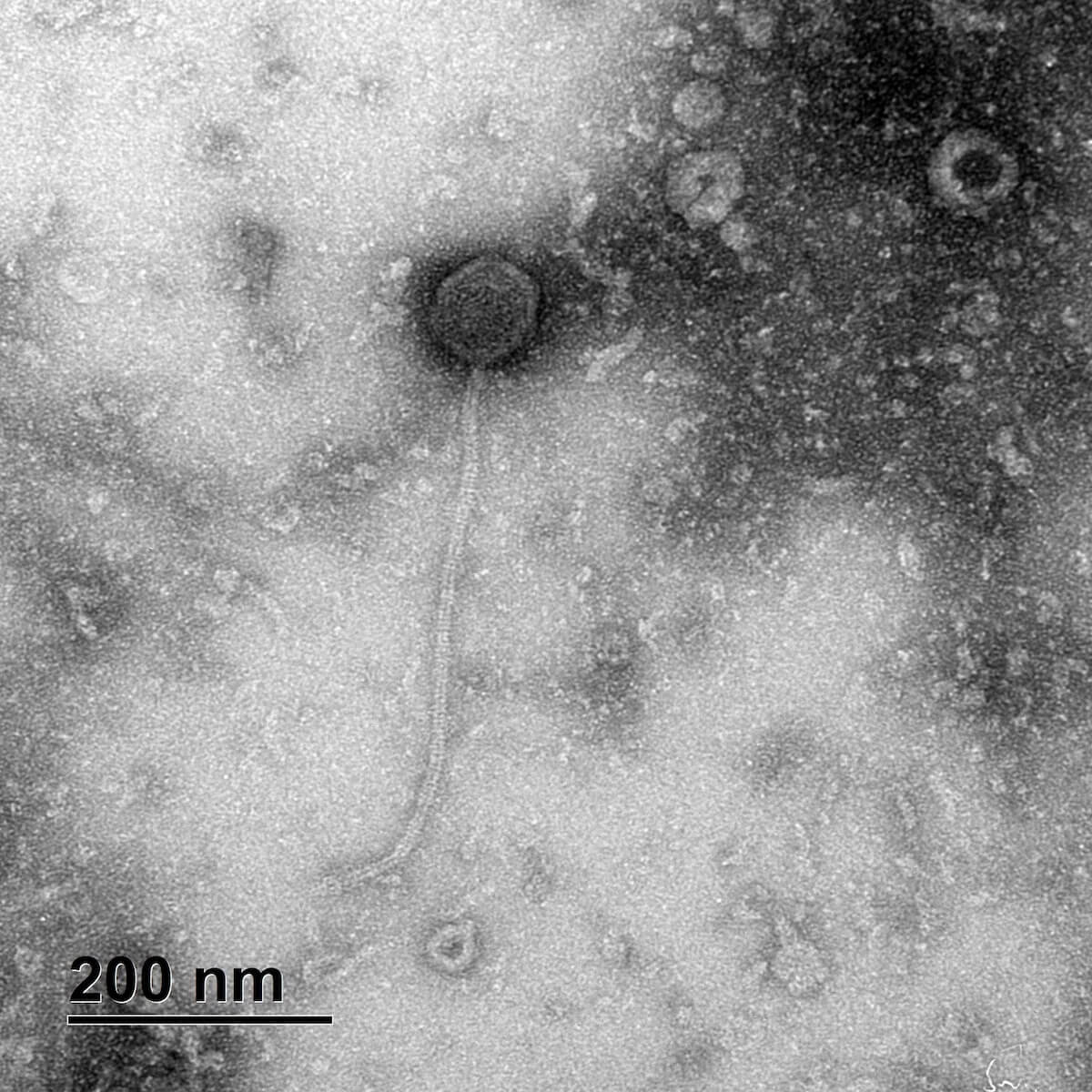 Transmission electron micrographs (TEM) image of phage S. pseud_22s